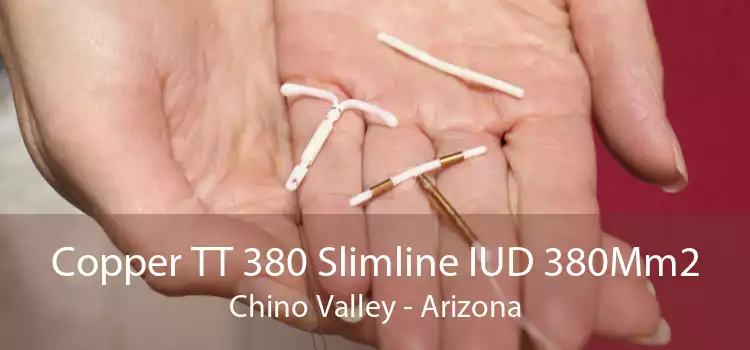 Copper TT 380 Slimline IUD 380Mm2 Chino Valley - Arizona
