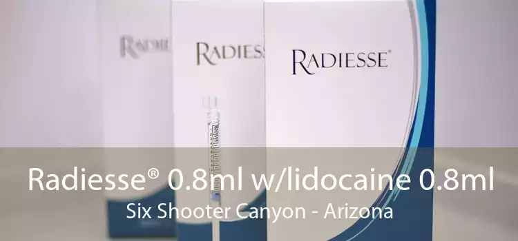 Radiesse® 0.8ml w/lidocaine 0.8ml Six Shooter Canyon - Arizona